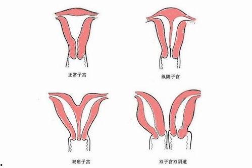 双阴道视频,揭秘罕见生理现象的视觉之旅